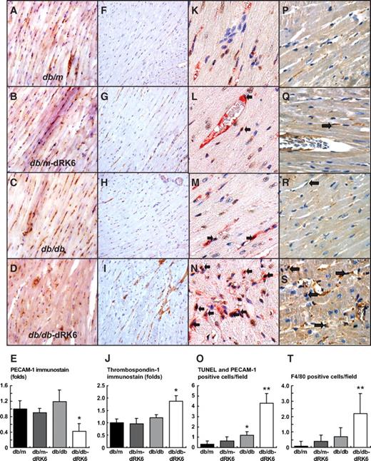 FIG. 5. Myocardial morphology and immunohistochemical staining for PECAM-1, thrombospondin, TUNEL+PECAM-1, and F4/80 in the hearts of diabetic db/db and nondiabetic db/m mice with or without dRK6 treatment. A representative photomicrograph of myocardial immunostaining for PECAM-1 in nondiabetic db/m (A), db/m-dRK6 (B), diabetic db/db (C), and db/db-dRK6 mice (D, ×200). Original magnification ×200. Representative immunostains for thrombospondin-1 (F–I, ×200), PECAM-1+TUNEL (a dark-brown nuclear for TUNEL-positive and a red cytoplasm for PECAM-1–positive; open arrow, K–N, ×400) and F4/80 (open arrow, P–S, ×400) in diabetic and nondiabetic db/db and db/m mice with or without dRK6 treatment. Quantitative assessment of PECAM-1 (E), thrombospondin-1 (J), PECAM-1+TUNEL (O), and F4/80 (T) immunoreactivity in diabetic db/db and nondiabetic db/m mice without or with dRK6 treatment. *P < 0.05, **P < 0.01 compared with the other groups. (A high-quality color digital representation of this figure is available in the online issue.)