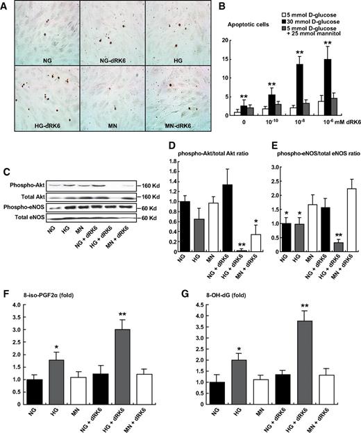 FIG. 7. The effect of dRK6 on apoptosis in the HUVECs, determined by in situ TUNEL assay. Representative pictures of TUNEL-positive HUVECs (A, original magnification ×200). The apoptosis of HUVECs treated with different doses of dRK6 (10−6, 10−8, and 10−10 mmol/l) and concentrations of glucose in the media (5 and 30 mmol/l of d-glucose, and 5 mmol/l d-glucose + 25 mmol/l mannitol) for 48 h (B). Representative Western blots for total and phospho-Akt and phospho-eNOS (C–E). 8-Iso-PGF2α (F) and 8-OH-dG (G) concentrations of cell culture media in each group. *P < 0.05, **P < 0.01 compared with HG or HG+dRK6. NG, 5 mmol/l of d-glucose; HG, 30 mmol/l d-glucose; MN, 5 mmol/l d-glucose + 25 mmol/l mannitol; +dRK6, treated with dRK6. *P < 0.05, **P < 0.01 compared with the other groups; n = 4. HG, high glucose; NG, normal glucose. (A high-quality color digital representation of this figure is available in the online issue.)
