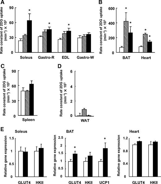 FIG. 1. Effects of leptin injection into the VMH on glucose uptake and gene expression in peripheral tissues. The rate constant of 2[3H]DG uptake was measured in skeletal muscle (A), BAT and heart (B), spleen (C), and epididymal WAT (D) at 3 and 6 h after injection of leptin or saline (control) into the VMH of mice. □, Saline VMH (6 h); ▧, leptin VMH (3 h); ■, leptin VMH (6 h). E: The mRNA levels of GLUT4, hexokinase II (HKII), and UCP1 in soleus, BAT, and heart were quantified by real-time PCR. Values are normalized by the level of eEF2 mRNA. Gastro-R, red portion of gastrocnemius; Gastro-W, white portion of gastrocnemius. Data are means ± SE for four to seven mice. *P < 0.05 vs. the corresponding value for saline-injected controls. □, Saline VMH (6 h); ■, leptin VMH (6 h).