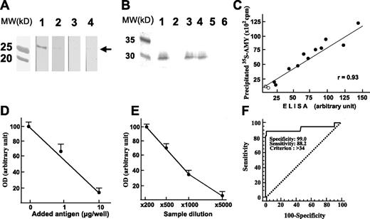 FIG. 2. Western blot analysis and ELISA for detecting anti-human AMY-2A. A: Western blot analysis. Recombinant human AMY-2A (50 ng) from codons 299 to 512 (AMY-2A/299–512) was electrophoresed in 0.1% SDS–15% polyacrylamide and transferred onto a nitrocellulose filter. The filters reacted with serum (×1,000) from an AIP patient (line 1) and normal control sera (lines 3 and 4). Line 2, AIP patient's serum preincubated with 1 μg/ml AMY-2A/299–512. MW, molecular weight markers. B: Immunoprecipitation of 35S–AMY-2A with antibodies. 35S–AMY-2A was incubated with goat anti-amylase (line 1), normal goat IgG (line 2), sera from AIP patients (lines 3 and 4), and sera from healthy volunteers (lines 5 and 6) and then precipitated with protein G–sepharose. The pellets were electrophoresed in 0.1% SDS–15% polyacrylamide and analyzed with Bas 2000 image analyzer (Fujix, Tokyo). C: Correlation between the result of ELISA and that of immunoprecipitation. By coating the recombinant human AMY-2A/299–512, we developed an ELISA system for detecting anti-human AMY-2A. Sera from 11 patients with AIP (•) and two normal control subjects (○) were assayed by ELISA and immunoprecipitation for detecting the autoantibody. D: Absorption of positive ELISA signal with recombinant AMY-2A. One milliliter of a patient's serum (1:500) was preincubated with the recombinant protein at the indicated dose overnight at 4°C, and then the serum was used as the first antibody. The data are the mean of triplicate values. OD, optical density. E: Serum dilution experiment in ELISA assay. Positive serum from patient A.O. was diluted as indicated, and ELISA assay was carried out. The data are the mean of triplicate values. F: ROC analysis of the healthy volunteers and fulminant type 1 diabetic patients. We carried out ROC analysis of the healthy volunteers (n = 100) and fulminant type 1 diabetic patients (n = 17) with MedCalc.