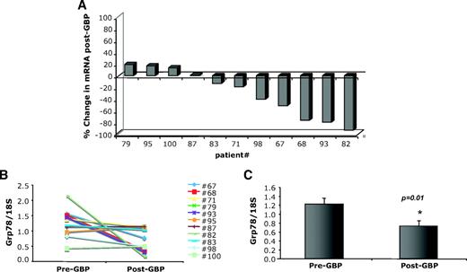 FIG. 3. Regulation of Grp78 mRNA in GBP subjects. Quantitative RT-PCR was performed on RNA isolated from adipose tissue of patients before and after GBP, n = 11. A: Percent change in Grp78 mRNA from pre-GBP levels in each individual patient. B: Pre- and post-GBP surgery levels of Grp78 mRNA normalized to 18S ribosomal RNA. C: Average mRNA levels for Grp78 in pre- and post-GBP groups. Data indicate mean ± SE. *P < 0.02.