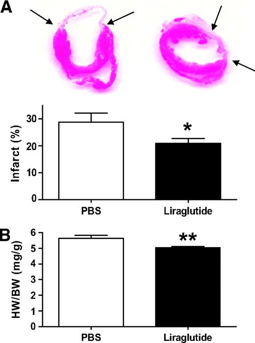 FIG. 2. Effects of liraglutide pretreatment on infarct size and heart weight. A: Representative photomicrographs of H-E–stained hearts 28 days post-MI depict decreased infarct size (arrows) in liraglutide- (n = 36) versus PBS-treated mice (n = 21) as confirmed by morphometric quantification of percent total LV circumference (*P = 0.025). B: HW/BW ratio was reduced in liraglutide- versus PBS-treated mice 28 days post-MI (n = 36 and 21, respectively; **P = 0.001). Data shown are means ± SE. (A high-quality digital representation of this figure is available in the online issue.)