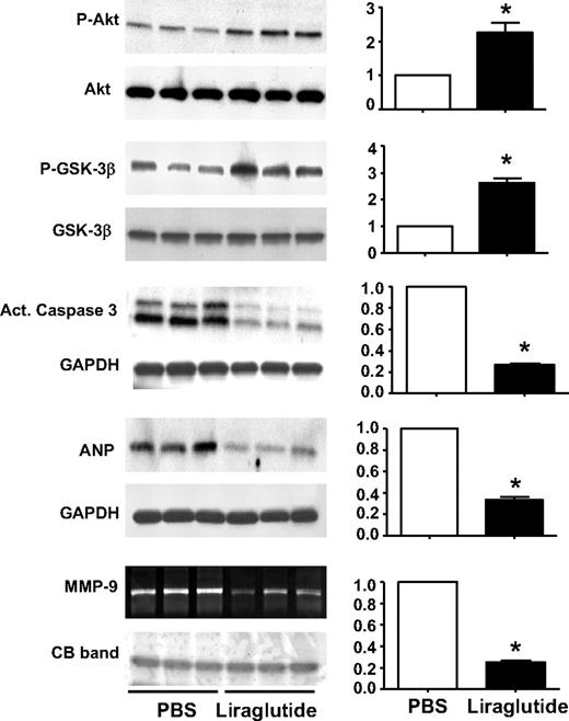FIG. 4. Effects of liraglutide pretreatment on cardioprotective signaling pathways after MI in mice. Liraglutide pretreatment for 7 days has persistent cardioprotective effects detectable 4 days post-MI as indicated by representative Western blots and corresponding densitometric quantification (n = 6/group) of fold changes in phosphorylation of Akt and GSK3β, cleavage of caspase-3, and expression of ANP and activity of MMP-9 by zymography in liraglutide- versus PBS-treated mice. Data shown are means ± SE; *P < 0.05.