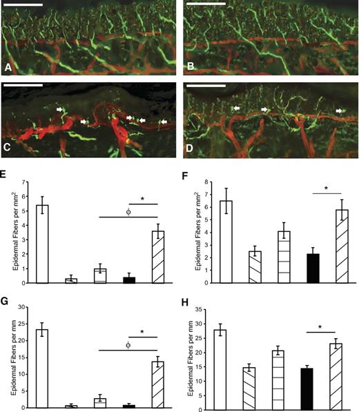 FIG. 5. Epidermal footpads from mice with and without diabetes were assessed. The basement membrane and vasculature were identified with immunohistochemistry for collagen type IV (red). Epidermal axons were identified with PGP 9.5 (green) for a control I-S mouse (A), control I-I mouse (B), diabetic I-S mouse (C), and diabetic I-I mouse (D). Note the presence of epidermal end bulbs (arrows) in axons of diabetic mice. Diabetes was associated with the loss of epidermal nerve fibers (per epidermal area [E, hindfoot; F, forefoot] and length [G, hindfoot; H, forefoot]), with partial preservation in diabetic I-I mice and less preservation in diabetic S-I mice (□, C S-S; ▧, D S-S; , D S-I; ■, D I-S; ▨, D I-I). All measures of epidermal fiber density are listed as means ± SEM. Asterisk indicates significance with comparison of diabetic I-I and diabetic I-S mice; φ indicates significance with comparison of diabetic I-I and diabetic S-I mice (nonmatched ANOVA tests, F-values range between 0.89 and 5.21 for indicated groups and time points, df = 5,3, n = 5–6). Bar = 100 μm. C, control; D, diabetic; I-S, intranasal saline; I-I, intranasal insulin; S-I, subcutaneous insulin. (A high-quality digital representation of this figure is available in the online issue.)