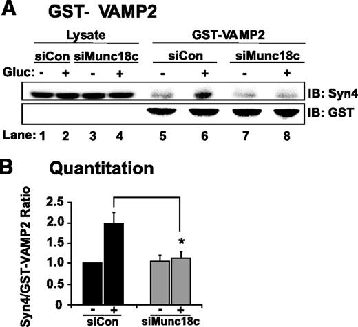 FIG. 7. Depletion of Munc18c decreases Syntaxin 4 accessibility to VAMP2. Detergent cell lysates prepared from MIN6 cells transduced with siCon-Ad or siMunc18c-Ad were incubated with purified GST-VAMP2 linked to beads. GST-VAMP2 and associated proteins were subjected to 12% SDS-PAGE for immunoblotting (IB) with anti–Syntaxin 4 (Syn4) antibody. Anti-GST immunoblotting shows equal loading of GST-VAMP2. Data represent the mean ± SE of five independent sets of lysates (*P < 0.05). Gluc, glucose.