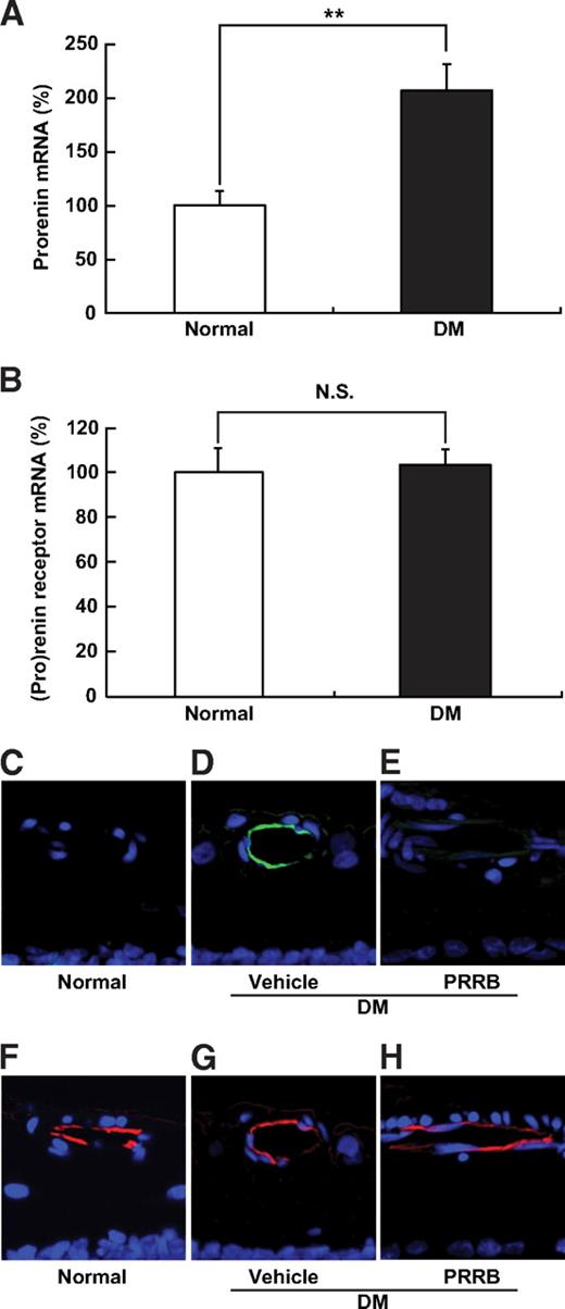 FIG. 1. Upregulation of prorenin expression and tissue localization of prorenin and the (pro)renin receptor in the diabetic retina. A: Upregulation of prorenin mRNA levels, analyzed by real-time RT-PCR, in the retina by inducing diabetes (DM) (n = 8). B: (Pro)renin receptor mRNA levels were unchanged following induction of diabetes (n = 8). Immunostaining for non–proteolytically activated prorenin (C–E) (green fluorescence) and the (pro)renin receptor (F–H) (red fluorescence) in retinal vessels. **P < 0.01. NS, nonsignificant. (A high-quality digital representation of this figure is available in the online issue.)