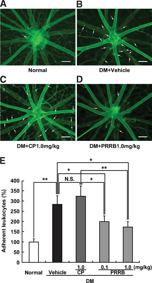 FIG. 2. Inhibitory effect of PRRB on retinal leukocyte adhesion. Flat-mounted retinas from normal (A) and diabetic (DM) rats treated with vehicle (B), control peptide (CP) (C), or PRRB (D). Scale bars: 100 μm. E: The number of retinal adherent leukocytes. PRRB-treated diabetic rats showed significantly fewer adherent leukocytes than did vehicle- or control peptide-treated diabetic rats (n = 5–13). *P < 0.05 and **P < 0.01. NS, nonsignificant. (A high-quality digital representation of this figure is available in the online issue.)
