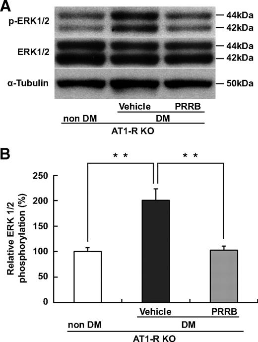 FIG. 6. RAS-independent (pro)renin receptor–mediated intracellular signaling contributes to ERK1/2 activation in the diabetic retina. A and B: Western blotting for phosphorylated and total levels of ERK1/2 in AT1-R–deficient mice with diabetes (DM). PRRB suppressed relative phosphorylation of ERK1/2 (n = 12). **P < 0.01. KO, knockout.