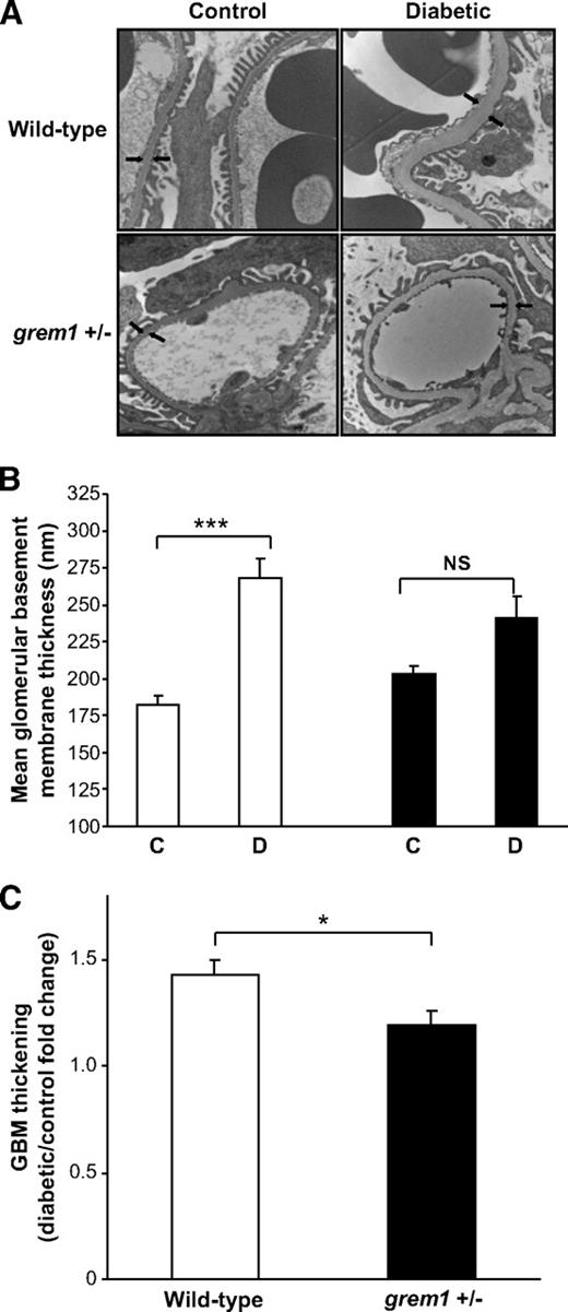 FIG. 3. Glomerular basement membrane thickening is attenuated in diabetic grem1+/− mice compared with wild-type. Kidney pieces were processed as described in research design and methods, and 100-nm sections were cut from the renal pole harvested from control and diabetic wild-type and grem1 ± mice at 27 weeks. Sections were viewed with an FEI CM-12 transmission electron microscope operated at 80 keV. Glomeruli were randomly selected, viewed at ×15,000 magnification and serial measurements along the GBM were assessed. Arrows indicate the position of the glomerular basement membrane (A). Top left, nondiabetic wild-type (+/+) control; top right, diabetic wild-type (+/+); bottom left, nondiabetic grem1+/− control; bottom right, diabetic grem1+/−. Arrows indicate the thickness of the GBM. B and C: Quantitation of GBM thickness from all groups of mice. Up to 60 serial measurements were made from each individual glomerulus, and a mean value per mouse was calculated. Data are plotted as group means ± SE. GBM thickness was significantly higher in wild-type diabetic mice compared with nondiabetic controls (P < 0.001 using one-way ANOVA and Tukey-Kramer multiple comparison test, n = 7–11 per group). The increase observed in diabetic grem1+/− mice compared with controls did not reach significance (P = 0.224). Fold change in GBM thickening. Mean GBM thickness values for each diabetic animal were divided by the mean thickness for control mice for both wild-type and grem1+/− groups. Mean fold change values were calculated for both wild-type and grem1+/− mice at 27 weeks. *P < 0.05, Student's two-tailed t test. □, wild type; ■, grem1+/−.