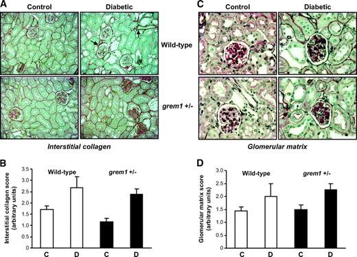 FIG. 4. Mild structural changes are evident in diabetic wild-type and grem1+/− mice by light microscopy. Post mortem, mouse kidneys were fixed by perfusion fixation in situ using 4% (wt/vol) paraformaldehyde, and 3-μm paraffin-embedded sections were stained with (A) Picrosirius red to detect interstitial collagen or (C) periodic acid Schiff to assess glomerular matrix secretion. Slides (n = 5 for each group) were scored blindly by an independent renal pathologist on a scale of 0–4. Data are plotted as mean scores ± SE for control (C) or diabetic (D) mice in wild-type (□) or grem1+/− (■) mice. Observed increases in both glomerular matrix secretion (B) or collagen staining (D) did not reach significance using Student's two-tailed t test. (A high-quality digital representation of this figure is available in the online issue.)