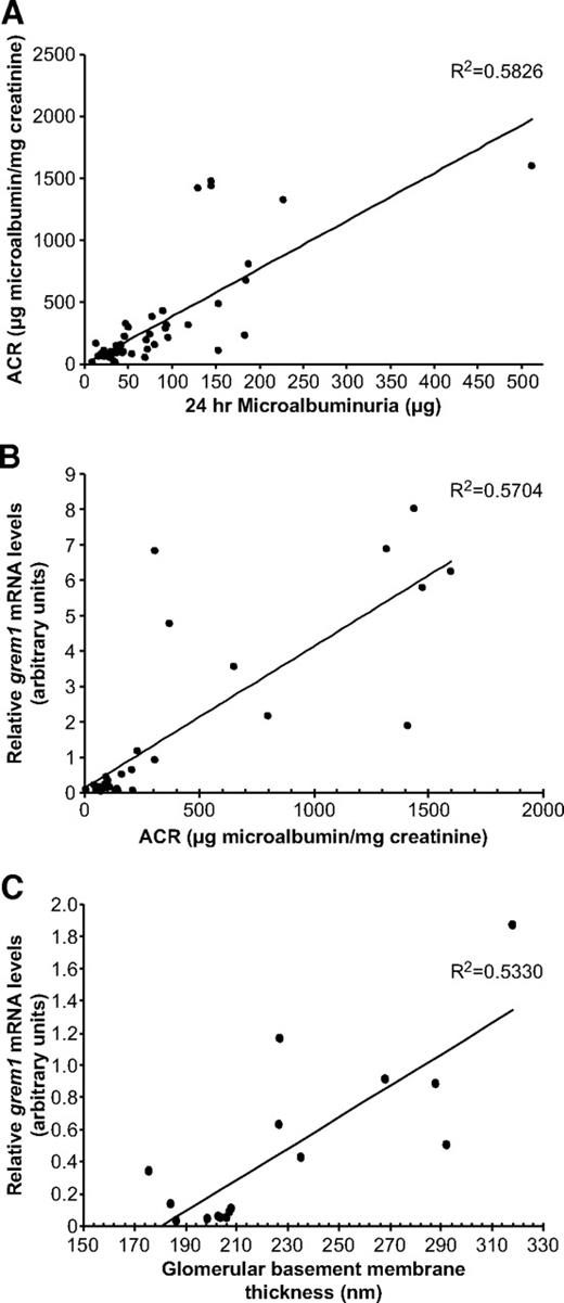 FIG. 6. grem1 mRNA levels correlate with indexes of renal damage. A: Twentyfour microalbumin values (micrograms) were plotted against ACR values (micrograms of microalbumin per milligrams of creatinine) for wild-type and grem1+/− control and diabetic mice over the course of the study (n = 50). R2 value of the trendline was calculated at 0.5846 (n = 49), two-tailed P < 0.0001 using Spearman's rank correlation analysis. B: grem1 mRNA levels were plotted against ACR values for wild-type and grem1+/− mice. The cohort of control and diabetic mice of both genotypes at 18 and 27 weeks of diabetes were plotted (n = 30). Spearman rank correlation analysis revealed an R2 value of 0.5704 with a two-tailed P < 0.0001. (C). grem1 mRNA values were plotted against mean GBM thickness for control and diabetic wild-type and grem1+/− mice at 27 weeks of diabetes (n = 17). R2 = 0.533, two-tailed P < 0.001, using Spearman's rank correlation analysis.