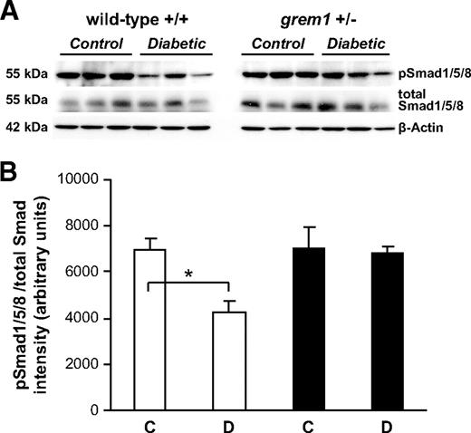FIG. 8. Decreased pSmad1/5/8 phosphorylation is evident in wild-type but not grem1+/− diabetic kidney. A: Protein extracts from renal poles of control (C) and 27-week diabetic (D) wild-type (□) and grem1+/− (■) mice were probed via Western blot using phospho-Smad1/5/8, total Smad1/5/8, and β-actin antibodies as described. n = 3 mice per group. B: Densitometry was performed using Scion Image software. pSmad1/5/8 intensities were normalized to total Smad1/5/8 levels and plotted as relative intensity. *P < 0.05 using Student's unpaired t test.