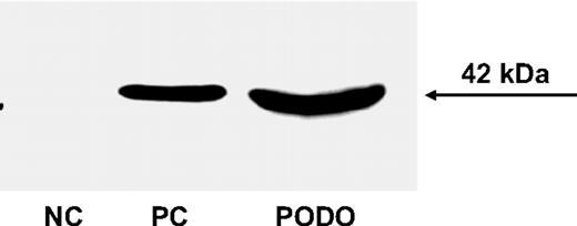 FIG. 1. The CCR2 receptor is expressed by human podocytes. CCR2 protein expression was studied in human cultured podocytes by immunoblotting as described in research design and methods. Total proteins were separated by SDS gel electrophoresis, transferred to nitrocellulose membranes, and probed for the CCR2 receptor by immunoblotting using a rabbit anti-human CCR2 antibody. A representative immunoblot is shown of the specific band for CCR2 at ∼42 kDa. NC: negative control obtained by omitting the primary antibody. PC: positive control of total protein extracts from the monocyte cell line THP-1. PODO: total protein extracts from human podocytes.