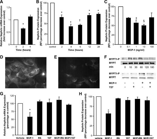 FIG. 2. MCP-1 reduces nephrin mRNA and protein expression via a CCR2-Rho-dependent mechanism in cultured human podocytes. A: Nephrin mRNA levels measured by real-time PCR in podocytes exposed to either vehicle or rh-MCP-1 (10 ng/ml) for 2 and 4 h. Results were corrected for the expression of the housekeeping gene glyceraldehydes-3-phosphate dehydrogenase and expressed as percentage decrease as compared with control subjects (n = 3, *P < 0.01 rh-MCP-1 at 2 h vs. control subjects). B: Podocytes were exposed to rh-MCP-1 (10 ng/ml) for 2, 4, 6, 12, and 24 h and (C) to rh-MCP-1 (0.1–1 to 10–100 ng/ml) for 4 h. Nephrin expression, assessed by immunofluorescence, was expressed as percentage change in RFI as compared with control subjects (n = 3 *P < 0.01 rh-MCP-1 at 2, 12, and 24 h over control subjects [□]; †P < 0.001 rh-MCP-1 at 4 and 6 h over control subjects; ‡P < 0.05 rh-MCP-1 at 1 ng/ml over control subjects; §P < 0.001 rh-MCP-1 at 10 ng/ml over control subjects). Representative immunofluorescence images are shown in D (vehicle) and E (rh-MCP-1 at 10 ng/ml for 4 h). Magnification ×400. F: Podocytes were exposed to MCP-1 (10 ng/ml) for 0, 10, 30, 60, 120, and 180 min (upper panel) and 10 min in the absence and/or in the presence of Y27632 (Y27 10 μmol/l), a specific ROCK inhibitor (lower panel). Both total and phosphorylayed MYPT1 were assessed by immunoblotting on total protein extracts. Representative blottings are shown. G: Podocytes were exposed to rh-MCP-1 (10 ng/ml) in the presence and in the absence of RS102895 (RS 6 μmol/l), a CCR2 receptor antagonist, and Y27632 (Y27 10 μmol/l), a specific ROCK inhibitor, added 60 min before rh-MCP-1. After 2 h incubation, nephrin mRNA levels were measured by real-time PCR, corrected for the expression of the housekeeping gene glyceraldehydes-3-phosphate dehydrogenase, and expressed as percentage change over control (n = 3, *P < 0.05 rh-MCP-1 vs. others). H: At 4 h, nephrin protein expression was assessed by indirect immunofluorescence using a low-light video camera and expressed as percentage change in RFI as compared to control subjects (n = 3; *P < 0.05 rh-MCP-1 vs. others).