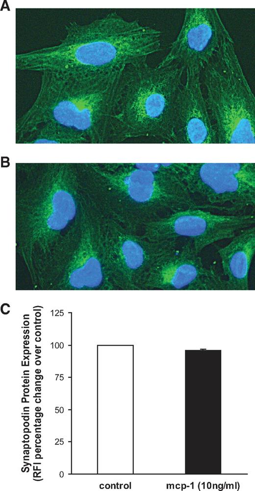 FIG. 3. MCP-1 effect on synaptopodin expression in cultured human podocytes. Podocytes were exposed either to rh-MCP-1 (10 ng/ml) (A) or vehicle (B) for 4 h, then synaptopodin expression assessed by immunofluorescence. Representative immunofluorescence images are shown (magnification ×800). C: Results were expressed as percentage change in RFI as compared with control subjects (n = 3 *NS rh-MCP-1 vs. control subjects). (A high-quality digital representation of this figure is available in the online issue.)