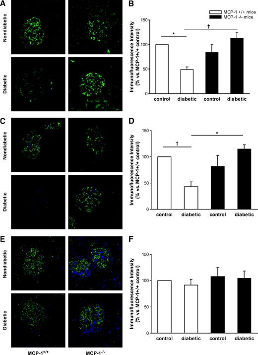 FIG. 5. Glomerular staining for nephrin, synaptopodin, and ZO-1 in diabetic wild-type and MCP-1 knockout mice. Kidney paraffin sections from both diabetic and nondiabetic MCP-1+/+ and MCP-1−/− mice were stained for nephrin, synaptopodin, and ZO-1 by immunofluorescence as described in research design and methods. B, D, and F: Quantification of glomerular staining for nephrin (*P < 0.01 diabetic MCP-1+/+ vs. nondiabetic MCP-1+/+ mice; †P < 0.001 diabetic MCP-1−/− vs. diabetic MCP-1+/+ mice), synaptopodin (*P < 0.01 diabetic MCP-1−/− vs. diabetic MCP-1+/+ mice; †P < 0.05 diabetic MCP-1+/+ vs. nondiabetic MCP-1+/+ mice), and ZO-1 (P = NS). A, C, and E: Representative figures of nephrin, synaptopodin, and ZO-1 glomerular staining. Magnification ×400. (A high-quality digital representation of this figure is available in the online issue.)