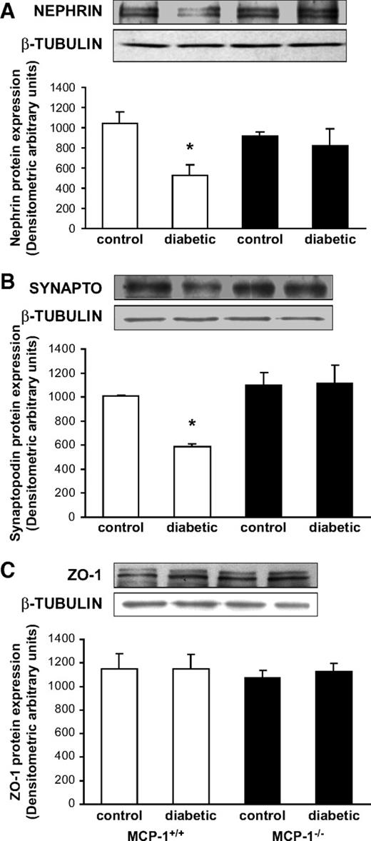 FIG. 6. Nephrin, synaptopodin, and ZO-1 expression in the renal cortex from diabetic wild-type and MCP-1 knockout mice. Nephrin (A), synaptopodin (B), and ZO-1 (C) expression was studied in renal cortex from both diabetic and nondiabetic MCP-1+/+ and MCP-1−/− mice by immunoblotting as described in research design and methods. Densitometry analysis and representative immunoblots are shown. *P < 0.05 diabetic versus others.