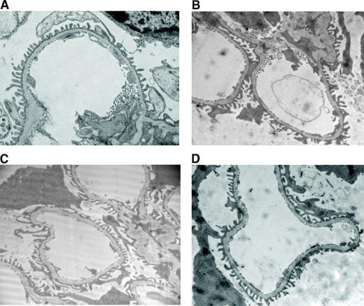 FIG. 7. Morphology of podocyte foot process (transmission electron microscopy, ×7,000) in nondiabetic MCP-1+/+ (A), diabetic MCP-1+/+ (B), diabetic MCP-1−/− (C), and nondiabetic MCP-1−/− (D) mice 10 weeks after the onset of STZ-induced diabetes.