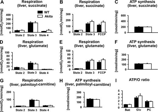 FIG. 3. Mitochondrial function in the liver. Respiration rates (A, B, D, E, and G) and ATP synthesis rates (C, F, and H) of mitochondria isolated from livers of 12-week-old wild-type (WT) (■) and Akita (□) mice, measured in the presence of succinate/rotenone (A–C) or glutamate/malate (D–F) or palmitoyl-carnitine/malate (G and H) as a substrate (n = 5–7). I: State 3 respiration and ATP synthesis rates were used to calculate ATP-to-O ratios for each substrate. There were no significant differences in any parameter. glu, glutamate; pc, palmitoyl-carnitine; suc, succinate.