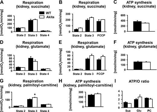 FIG. 4. Mitochondrial function in the kidney. Respiration rates (A, B, D, E, and G) and ATP synthesis rates (C, F, and H) of mitochondria isolated from kidneys of 12-week-old wild-type (WT) (■) and Akita (□) mice, measured in the presence of succinate/rotenone (A–C) or glutamate/malate (D–F) or palmitoyl-carnitine/malate (G and H) as a substrate (n = 5–7). I: State 3 respiration and ATP synthesis rates were used to calculate ATP-to-O ratios for each substrate. *P < 0.05 vs. wild type. glu, glutamate; pc, palmitoyl-carnitine; suc, succinate.