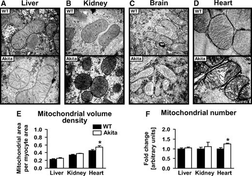 FIG. 6. Mitochondrial morphology. Representative longitudinal electron microscopy images of liver (A), kidney (B), brain (C), and heart (D) at a magnification of ×40,000 and quantification of mitochondrial volume density (E) and mitochondrial number (F), in liver, kidney, and heart tissue of 12-week-old wild-type (WT) (■) and Akita (□) mice (n = 4).