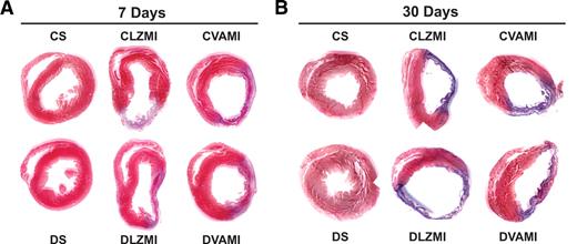 FIG. 2. Effect of combination gene therapy on myocardial fibrosis 7 and 30 days after gene therapy. A: Representative images show myocardial infarct and fibrosis after 7 days of MI and combination gene therapy. B: Representative images show myocardial infarct and fibrosis after 30 days of MI and combination gene therapy. There is no evident fibrosis in the CS and DS groups. A thinner infarct and significant fibrosis is evident in the CLZMI and DLZMI groups. Combination gene therapy in the CVAMI and DVAMI groups resulted in a thicker infarct containing islands of viable cardiac tissue. CS, nondiabetic control sham; DS, diabetic sham; CLZMI, nondiabetic control animals that received Ad.LacZ injections; DLZMI, diabetic animals that received Ad.LacZ injections; CVAMI, nondiabetic control animals that received combination gene therapy; and DVAMI, diabetic animals that received combination gene therapy. (A high-quality color digital representation of this figure is available in the online issue.)