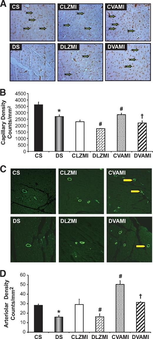 FIG. 3. Effect of combination gene therapy on capillary and arteriolar density 7 days after the intervention. Representative images (A) and graphical representation (B) of capillary density analysis among the different groups (counts/mm2). Representative images (C) and graphical representation (D) of arteriolar density analysis among the different groups (counts/mm2). There was a significant increase in the capillary and arteriolar density in the CVAMI and DVAMI groups compared with the CLZMI and DLZMI groups, respectively. CS (black solid bar), nondiabetic control sham; DS (gray solid bar), diabetic sham; CLZMI (white bar), nondiabetic control animals that received Ad.LacZ injections; DLZMI (diagonal brick bar), diabetic animals that received Ad.LacZ injections; CVAMI (wave bar), nondiabetic control animals that received combination gene therapy; and DVAMI (wide upward diagonal bar), diabetic animals that received combination gene therapy. Values are presented as mean ± SEM. *P ≤ 0.05 when DS is compared with CS, #P ≤ 0.05 compared with CLZMI, †P ≤ 0.05 when DVAMI is compared with DLZMI. (A high-quality color digital representation of this figure is available in the online issue.)