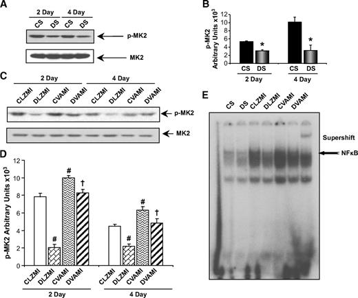 FIG. 5. Effect of combination gene therapy on phosphorylation of MK2 (Western blot) and DNA binding activity of NFκB (electrophoretic mobility shift assay [EMSA]). A: Representative Western blots for p-MK2 comparing CS and DS groups, 2 and 4 days after the surgery. B: Graphical representation of p-MK2 in the CS and DS groups, 2 and 4 days after the therapy. C: Representative Western blots for p-MK2 comparing CLZMI, DLZMI, CVAMI, and DVAMI groups, 2 and 4 days after the therapy. D: Graphical representation of p-MK2 in the CLZMI, DLZMI, CVAMI, and DVAMI groups, 2 and 4 days after the therapy. The gene therapy significantly increased the levels of p-MK2, 2 and 4 days after the therapy. E: EMSA analysis reveals increased DNA binding activity of NFκB in the CVAMI and DVAMI groups compared with the CLZMI and DLZMI groups, respectively. CS (black solid bars), nondiabetic control sham; DS (gray solid bars), diabetic sham; CLZMI (white bar), nondiabetic control animals that received Ad.LacZ injections; DLZMI (diagonal brick bar), diabetic animals that received Ad.LacZ injections; CVAMI (wave bar), nondiabetic control animals that received combination gene therapy; and DVAMI (wide upward diagonal bar), diabetic animals that received combination gene therapy. Values given as mean ± SEM. *P ≤ 0.05 when DS is compared with CS, #P ≤ 0.05 compared with CLZMI, †P ≤ 0.05 when DVAMI is compared with DLZMI.