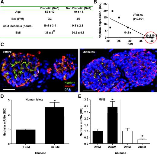 FIG. 1. Modulation of nephrin expression by diabetes and glucose. A: Characteristics of pancreas donors with or without type 2 diabetes. BMI was significantly different among groups. B: Correlation between the nephrin mRNA expression relative quantification (RQ) in isolated islets and BMI among the 12 patients studied. An r2 of 0.75 with P < 0.001 revealed that higher BMIs were associated with lower nephrin expression. Circled in red are the five diabetic donors. n = 2 denotes overlapping points. C: A representative immunofluorescence confocal image for nephrin, insulin, and DAPI in human islets from a diabetic and nondiabetic donor is shown (20× magnification). A white scale bar of 50 μm is provided. D–E: Quantitative analysis of nephrin mRNA expression in human islets (D) or MIN6 cells (E, ■) cultured at either 2 or 20 mmol/l glucose for 24 h. Chronic exposure to high glucose concentration was tested in MIN6 cells only. Cells “starved” in 2 mmol/l glucose for 7 days were assigned to either 2 or 20 mmol/l glucose culture for an additional 14 days. A downregulation of nephrin mRNA expression was observed (E, □). Mean and SD of four independent experiments are shown. *P < 0.05. (A high-quality color digital representation of this figure is available in the online issue.)