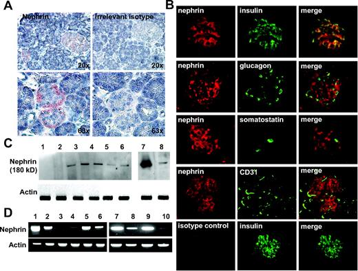 FIG. 2. Nephrin is expressed in human islets and β-cells. A: Immunostaining for nephrin on normal human pancreas revealed a predominant localization of nephrin to both small and large islets. B: Immunofluorescence colocalization studies revealed a predominant localization of nephrin (red) to insulin-producing cells (green, first row) but not to glucagon, somatostatin, and CD31-positive cells (green, subsequent rows). An irrelevant IgG2b was used as control and is shown in the last row. C: Western blotting analysis for nephrin. 1: COS7 (negative control), 2: human podocytes, 3: fetal human pancreas, 4–6: human islets from three different donors, 7: human kidney, 8: MIN6 cells. D: Standard RT-PCR for nephrin and actin. Samples 1–6 are of human origin, whereas 7–10 are of mouse origin. 1: kidney, 2: fetal pancreas, 3 and 5: whole pancreas from two different donors, 4 and 6: islets from same donors, 7: kidney, 8: islets, 9: fetal pancreas, and 10: MIN6 cells. (A high-quality color digital representation of this figure is available in the online issue.)