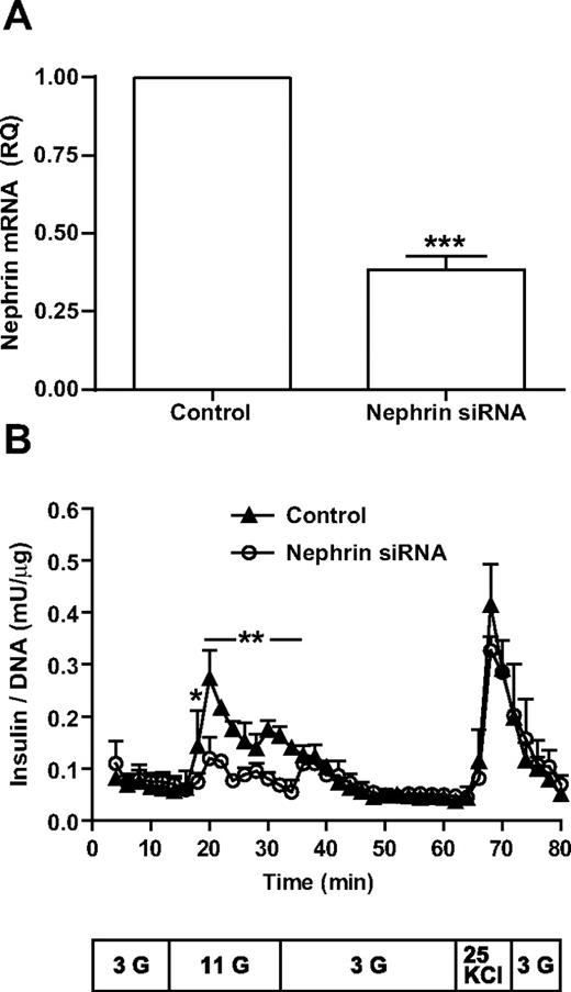 FIG. 4. Nephrin affects glucose responsiveness in human islets. A: Dispersed dissociated human islets exposed to either nephrin siRNA or nontargeting siRNA (control). PCR analysis of nephrin siRNA efficiency from four independent experiments reached a mean value of 62%. ***P < 0.001. B: Nephrin siRNA (○) or nontargeting siRNA (control, ▲) were perifused with 3 mmol/l glucose (G), 11 mmol/l glucose, 3 mmol/l glucose, 25 mmol/l KCl, and 3 mmol/l glucose in the time and sequence described in the text box below the graph. A graphic representation of four independent experiments with mean and SD for each time point is provided. *P < 0.05, **P < 0.001.