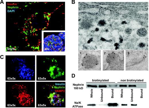 FIG. 5. Nephrin colocalizes with vesicles in β-cells. A: 63×5× and 40× magnified confocal images of human pancreatic β-cells and of human islets reveals a granular cytoplasmic nephrin localization (green) with partial overlap with insulin (red). B: Double-immunogold labeling for nephrin (10 nm gold) and insulin (5 nm gold) in human pancreatic sections. Enlarged are a single insulin vesicle (1), an insulin vesicle fused to the plasma membrane (2), and a plasma membrane without insulin vesicle (3), showing the localization of nephrin in the different phases of insulin secretion. C: Confocal microscopy at 63× magnification of MIN6 cells showing a more intense nephrin staining (green) in insulin-positive cells (blue) but not necessarily in VAMP2-positive cells (red). D: Biotinylation of MIN6 cells and separation of plasma membrane (bound) and cytoplasmic (unbound) fractions revealed that only a modest fraction of nephrin was localized to the plasma membrane and that the molecular weight of plasma membrane and cytoplasmic nephrin are identical. Blotting for Na/K ATPase confirmed a proper membrane and cytoplasm separation. All experiments were repeated four times. (A high-quality color digital representation of this figure is available in the online issue.)