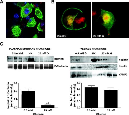 FIG. 6. Nephrin endocytosis occurs upon glucose stimulation. A: GFP-nephrin–transfected into MIN6 cells localizes both at the plasma membrane and in the cytoplasm. B: MIN6 cells starved in 2 mmol/l glucose revealed that nephrin is predominantly localized to the plasma membrane and only partially to FM6-64–stained vesicles (red). Upon stimulation with 20 mmol/l glucose, nephrin disappears from the plasma membrane and localizes solely to the endocytosed vesicles compartment. C: Plasma membrane and vesicle fractions were collected from MIN6 cells cultured in either 0.5 or 25 mmol/l glucose for 30 min. Human kidney (HK) was used as positive control for nephrin staining. While in 0.5 mmol/l glucose, nephrin was present in both plasma membrane (E-Cadherin positive) fractions and insulin vesicle fractions (insulin positive and VAMP2 positive); in 25 mmol/l glucose, nephrin almost disappeared from the plasma membrane. Shown are a representative blot analysis and the bar graph representation of the nephrin–to–E-cadherin ratios as well as the nephrin-to-insulin ratios (mean and SD of three independent experiments). **P < 0.01. (A high-quality color digital representation of this figure is available in the online issue.)