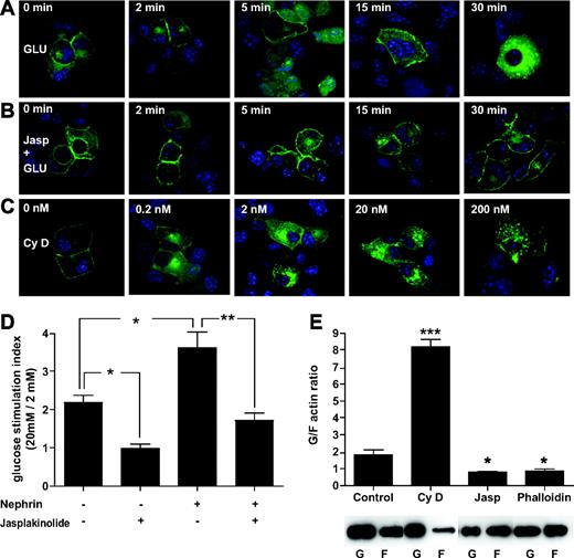 FIG. 7. Nephrin trafficking depends on actin and is essential for GSIR. A: GFP-nephrin–transfected into MIN6 cells is mainly localized at the sites of cell-to-cell contact in 2 mmol/l glucose. Upon glucose stimulation, nephrin undergoes a time-dependent endocytosis. B: Actin stabilization with 0.5 μmol/l jasplakinolide prevented glucose-induced relocation of GFP-nephrin from the plasma membrane to the cytoplasm. C: Actin depolymerization with cytochalasin D led instead to nephrin redistribution from plasma membrane to the cytoplasm in a dose-dependent manner. D: The positive effect of nephrin overexpression on GSIR was also totally prevented by pretreatment with 0.5 μmol/l jasplakinolide. *P < 0.05, **P < 0.01. All experiments were repeated four times. E: MIN6 cells exposed to cytochalasin D (Cy D), jasplakinolide (Jasp), and phalloidin were analyzed for the change in F-actin content compared to control untreated cells. While an increased G-to-F actin ratio was observed with CyD (***P < 0.001), both jasplakinolide and phalloidin treatment resulted in a 50% reduction of G-to-F actin ratios (*P < 0.05). (A high-quality color digital representation of this figure is available in the online issue.)