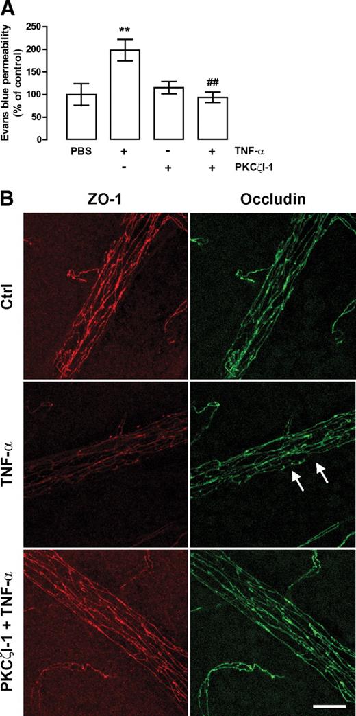 FIG. 8. PKCζI-1 prevents TNF-α–induced retinal vascular permeability in vivo. Animals' eyes were injected with PBS with 0.1% BSA, TNF-α (10 ng); PKCζI-1 (280 ng); or with both PKCζI-1 and TNF-α. A: Evans blue leakage was evaluated 24 h after intravitreous injections. The results represent the mean ± SEM (n = 7–8 animals per group) and are expressed relative to control (Ctrl; PBS-injected eyes). **P < 0.01, significantly different from control; ##P < 0.01, significantly different from TNF-α, as determined by ANOVA followed by Bonferroni post hoc test. B: PKCζI-1 prevents the alterations in tight junction proteins induced by TNF-α in vivo. Whole retinas were immunolabeled for ZO-1 and occludin 4 h after injection. Images were obtained on a Leica TCS SP2 AOBS confocal microscope and are presented as a maximum projection. Arrows indicate loss and/or discontinuous cell border staining. Scale bar, 25 μm. (A high-quality digital representation of this figure is available in the online issue.)