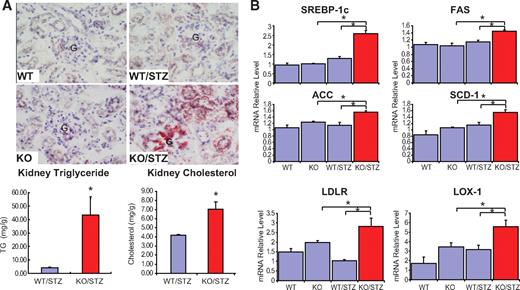 FIG. 3. Diabetic FXR KO kidney showed increased lipid accumulation. A: Oil red O staining of kidney sections and kidney lipid content showing lipid accumulation in diabetic FXR KO kidneys. G, glomerulus. B: Analysis of renal mRNA expression by quantitative real-time PCR for SREBP-1c, FAS, ACC, SCD-1, LDLR, and LOX-1 in isolated glomeruli. *P < 0.05 vs. diabetic wild-type C57BL/6J mice on WD or as specified (n = 6 mice per group). (A high-quality digital representation of this figure is available in the online issue.)