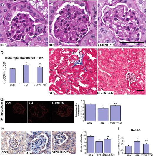 FIG. 4. INT-747 treatment improves renal pathology in diabetic DBA/2J mice. A–C: Representative PAS staining of kidney sections: nondiabetic DBA/2J, CON (A); diabetic DBA/2J without treatment, STZ (B); diabetic DBA/2J treated with INT-747, STZ/INT-747 (C). D: Mesangial expansion index defined by the ratio of mesangial area/glomerular tuft area. The mesangial area is determined by assessment of PAS-positive and nucleus-free areas in the mesangium. E and F: Representative Masson's trichrome staining of diabetic FXR KO kidney sections showing tubulointerstitial fibrosis: diabetic DBA/2J without treatment (E); diabetic DBA/2J treated with INT-747 (F). G: Immunofluorescence staining of kidney sections for synaptopodin. The expression level of synaptopodin was normalized to that in the control group. H: Immunohistologic detection of WT1 in glomeruli. Podocyte density is presented as the numbers of podocytes per glomerular area. I: Notch1 renal mRNA expression level determined by quantitative real-time PCR. Scale bar: A–C, 50 μm (shown in C); E and F, 50 μm (shown in F). *P < 0.05 vs. CON; **P < 0.05 vs. STZ (n = 6 mice per group). (A high-quality digital representation of this figure is available in the online issue.)