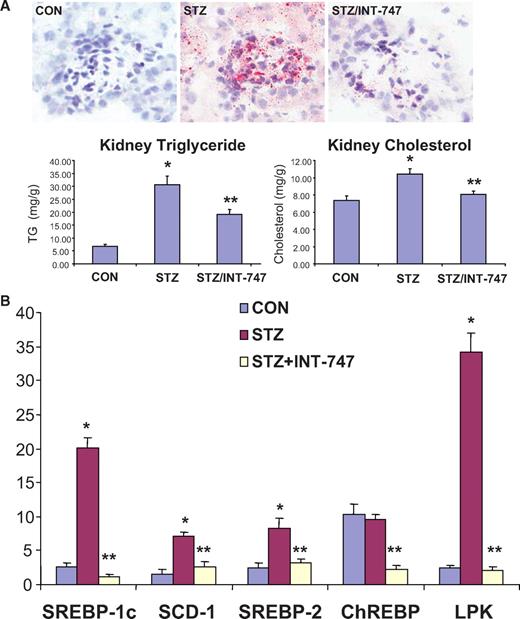 FIG. 6. INT-747 treatment modulates lipid accumulation. A: Oil red O staining of kidney sections and kidney lipid content showing lipid accumulation in diabetic DBA/2J kidneys blunted by INT-747 treatment. B: Analysis of renal mRNA expression by quantitative real-time PCR for SREBP-1c, SCD-1, SREBP-2, ChREBP and LPK in isolated glomeruli. *P < 0.05 vs. CON; **P < 0.05 vs. STZ (n = 6 mice per group). (A high-quality digital representation of this figure is available in the online issue.)
