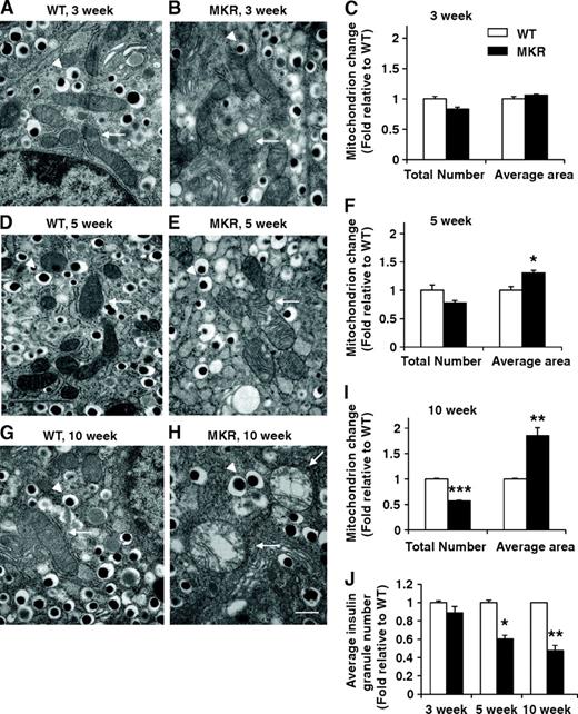 FIG. 4. Mitochondrial ultrastructure is disordered, and dense core insulin granule number is decreased in pancreatic β-cells from 5- and 10-week-old MKR islets. Electron micrographs are shown of ultra-thin sections of islets. β-Cells from 3-week-old WT mice (A) and MKR mice (B) had normal mitochondria (C). Mitochondria in β-cells of 5-week-old MKR mice (E) were slightly swollen (F). The mitochondria of β-cells from 10-week-old MKR diabetic mice (H) were reduced in number and severely swollen with disordered cristae (I) compared with normal mitochondrial morphology in WT control (G). 30,000× magnification. Scale bar equals 500 nm and is shown in the bottom right in H. White arrows indicate mitochondria. Arrowheads indicate insulin granules. Quantitation of total number of mitochondria and average mitochondrial area in 3-week-old (C), 5-week-old (F), and 10-week-old (I) WT and MKR electron microscopic sections. Dense core insulin granules were counted in images at 10,000× magnification (Fig. S6) and number was quantified (J). A total of 50–100 images were analyzed per age with 5–7 mice per genotype. Data are means ± SE. *P < 0.05; **P < 0.01; ***P < 0.001 compared with age-matched WT.