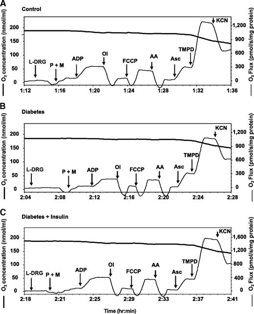 FIG. 1. Representative measurements of oxygen consumption in isolated lumbar DRG mitochondria from control, diabetic, and insulin-treated diabetic rats. Freshly isolated lumbar DRG mitochondria were assessed in control (A), diabetic (B), and insulin-treated (C) diabetic rats using OROBOROS oxygraph 2K as described in research design and methods. Thick lines indicate the level of oxygen in the chamber of electrode and expressed in nanomoles per milliliter. Thin lines indicate oxygen flux per mass (picomoles O2 per second per milligram protein) in the presence of specific substrates and inhibitors of the mitochondrial respiratory chain. L-DRG, lumbar dorsal root ganglia mitochondria; P, pyruvate (10 mmol/l); M, malate (5 mmol/l); ADP, adenosine diphosphate (2 mmol/l); Ol, oligomycin (1.0 μmol/l); FCCP, carbonyl cyanide 4-trifluoromethoxyphenylhydrazone (0.5 μmol/l); AA, antimycin A (1 μg/ml); Asc, ascorbate (5 mmol/l); TMPD, N,N,N′,N′-tetramethyl-p-phenylenediamine dihydrochloride (0.5 mmol/l); KCN, potassium cyanide (0.25 mmol/l).