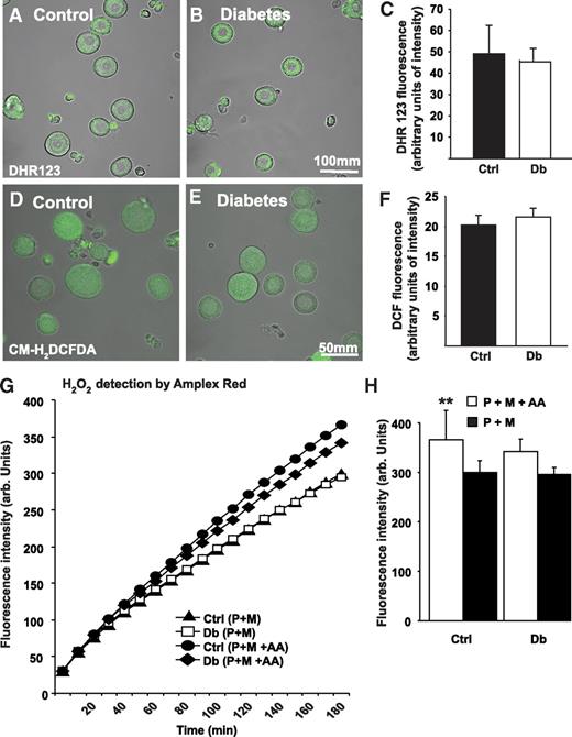 FIG. 5. ROS were not elevated in acutely isolated DRG sensory neurons or mitochondria from STZ-diabetic rats. A–F: ROS levels were assessed using real-time fluorescence imaging of DHR 123 or CM-H2DCFDA. A and B: DHR 123 loaded neurons from acutely isolated lumbar DRG neurons of control or STZ-diabetic rats. Bar = 100 μm. C: Quantification of DHR 123 fluorescence intensities of neurons. Values are means ± SEM (n = 50–80 neurons, observed in five independently assessed control (Ctrl) and diabetic (Db) rats). D and E: CM-H2DCFDA–based ROS imaging of sensory neurons from control and STZ-diabetic rats. Bar = 50 μm. F: Quantification of DCF fluorescence emission. Values are means ± SEM (n = 200–230 neurons, observed in two independently assessed control and diabetic rats). G: ROS generation is not elevated in isolated mitochondria from lumbar DRG of diabetic rats compared with control. Mitochondrial ROS generation was measured at state 4 with substrates pyruvate and malate (P + M) in the absence or presence of antimycin A (AA). H2O2 was measured fluorometrically in 0.1 mg/ml mitochondrial suspension with Amplex Red kits (50 μmol/l Amplex Red and 0.5 units/ml horseradish peroxidase). Values are mean with n = 5. H: Fluorescence intensity at 180 min. Significance level was determined by two-way ANOVA with Bonferroni's post hoc tests. **P < 0.01 for control (P + M) vs. control (P + M + AA). (A high-quality color representation of this figure is available in the online issue.)