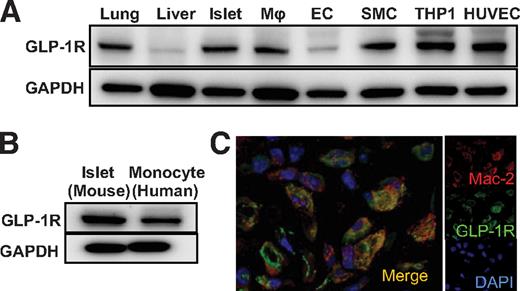 FIG. 1. Expression of GLP-1 receptor on macrophages. A: Expression of GLP-1 receptor in murine lung and liver, isolated murine islets, isolated murine macrophages (Mϕs), cultured murine endothelial cells (ECs), cultured murine smooth muscle cells (SMCs), human monocyte derived line, THP-1 cells, and HUVECs. B: Expression of GLP-1 receptor in human monocytes from healthy subjects. C: Immunohistochemical staining of GLP-1 receptor (green) and Mac-2, a marker of macrophages (red) in atherosclerotic lesions of apoE−/− mice. (A high-quality digital representation of this figure is available in the online issue.)