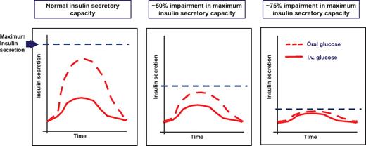 FIG. 2. Hypothetical impact of a general impairment in β-cell function on the incretin effect: In individuals with a normal insulin secretory capacity, an oral glucose load elicits a much greater insulin secretory response than an intravenous (i.v.) glucose load. With a decreasing β-cell secretory capacity, the insulin response to the oral glucose load is relatively more diminished than the insulin response to intravenous glucose infusion. By these means, the incretin effect, i.e., the difference in the insulin responses to oral and intravenous glucose, diminishes with declining β-cell function. For details, see text.