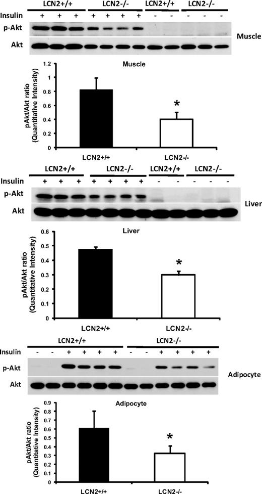 FIG. 4. In vivo insulin-stimulated Akt phosphorylation in LCN2−/− mice. Representative Western blot analysis of serine-phosphorylated Akt in muscle, liver, and isolated primary adipose cells from LCN2−/− (n = 4 per group) and wild-type mice (n = 4 per group) under basal and in vivo insulin-stimulated conditions.