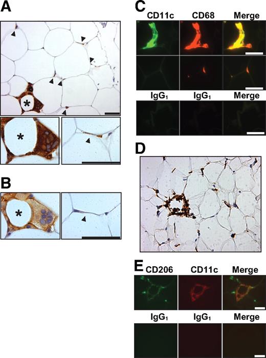 FIG. 1. Immunohistochemistry of subcutaneous adipose tissue in obesity. A: Formalin-fixed adipose tissue section stained for CD68 showing a crown (*) and several resident ATMs (arrowheads). B: Serial section stained for CD11c showing crown ATMs preferentially expressing CD11c. C: Formalin-fixed adipose section stained for CD11c and CD68 or with nonspecific isotype control antibodies confirming that crown ATMs (upper panel) but not resident ATMs (middle panel) express CD11c. D: Frozen adipose tissue section stained for CD206 showing a crown (*) and several resident ATMs. E: Frozen section stained for CD206 and CD11c (upper panel) or with isotype control antibodies (lower panel) showing crown ATMs expressing both CD11c and CD206 but resident ATMs expressing only CD206. Scale bar in all images = 50 μm. (A high-quality digital representation of this figure is available in the online issue.)