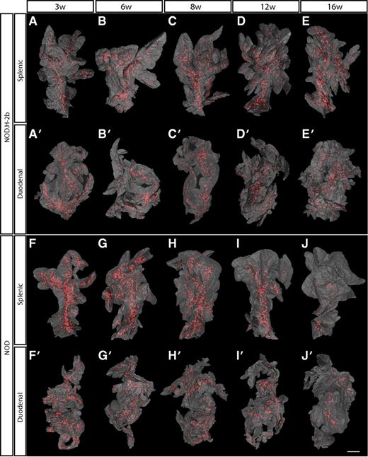 FIG. 1. Islet β-cell distribution over time in NOD.H-2b and NOD mice. A–J′: Isosurface rendered OPT images of representative NOD.H-2b splenic (A–E), duodenal (A′–E′), and NOD splenic (F–J) and duodenal (F′–J′) pancreata labeled for insulin (red). The pancreas outline (gray) is based on the signal from tissue autoflourescense. In contrast to NOD.H-2b mice (A–E′), the expected progressive destruction in islet β-cell volume is clearly observed in NOD mice (F–J′). Scale bar corresponds to 2.3 mm in I′; 2.1 mm in C; 2 mm in D, D′, J, J′, and G′; 1.9 mm in B and H; 1.8 mm in I and H′; 1.7 mm in C′ and E′; 1.6 mm in A, E, and F′; 1.5 mm in G; 1.4 mm in A′ and B′; and 1.2 mm in F. (A high-quality color representation of this figure is available in the online issue.)