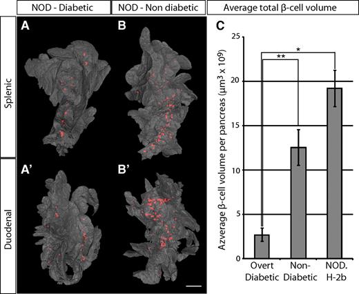 FIG. 5. Comparison of overt diabetic and nondiabetic NOD sibling pairs. A and B′: Isosurface rendered OPT images of representative diabetic (A and A′) and nondiabetic (B and B′) splenic (A and B) and duodenal (A′ and B′) pancreata labeled for insulin (red). The pancreas outline (gray) is based on the signal from tissue autoflourescense. C: Graph showing the average total β-cell volume in overt diabetic and nondiabetic NOD sibling pairs (n = 5 for each group, pairs analyzed at 14, 14, 18, 18, and 23 weeks) and in NOD.H 2b mice at 16 weeks (n = 3) ± SE. Scale bar is 2.2 mm in A′ and 2 mm in A, B, and B′. Significance levels are indicated, *P < 0.05; **P < 0.01. (A high-quality color representation of this figure is available in the online issue.)