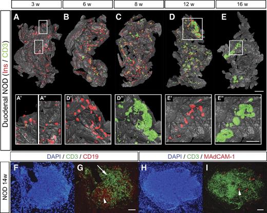 FIG. 6. Spatial assessment of the progression of autoimmune insulitis in the NOD mouse. A–E: Isosurface rendered OPT images of representative pancreata (duodenal) from NOD mice at 3, 6, 8, 12, and 16 weeks. Ins+ islets (red) are reconstructed based on the signal from insulin-specific antibodies and infiltrating T-cells (green) based on the signal from CD3-specific antibodies. A′–E′′, insets: High-magnification views corresponding to the enclosed boxes in A, D, and E, respectively. n = 3 for 3, 6, 8, and 12 weeks; n = 5 for 16 weeks. Ins, insulin. F and G: Sections of a pancreata from a 14-week-old female NOD mouse stained with DAPI, anti-CD3 (green), and anti-CD19 (red) (F) or anti-CD3 (green) and anti-MAdCAM-1 (red) (G). F: B-cell areas (arrow head) and T-cell areas (arrow) are indicated by arrow head. G: High endothelial venules (arrow head). The scale bar in E corresponds to 2 mm in E, 1.5 mm in C, 1.4 mm in B, 1.3 mm in D, and 1.0 mm in A. The scale bar in E″ corresponds to 1 mm in E″, E′, D″, D′, and 0.76 mm in A″, A′. Scale bar in G corresponds to 100 μm in F and G. Scale bar in I corresponds to 100 μm in H and I. (A high-quality color representation of this figure is available in the online issue.)