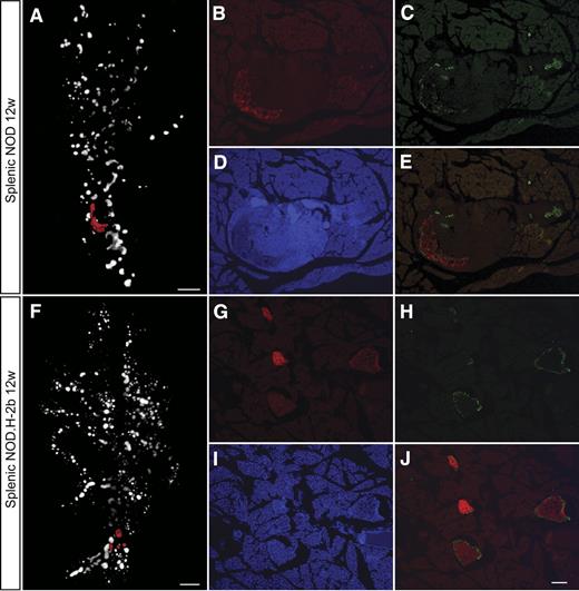 FIG. 7. Comparision of α- and β-cell distribution in 12w NOD and NODH2b mice. A: and F: Volume renderings of β-cell distribution. Cryosections in B–E and G–J correspond to red pseudocolor in A and F, respectively. Sections were counterstained against glucagon (C, E, H, and J) and DAPI (D and I). Note the remaining Glu+ cells in the highly infiltrated NOD islets (C and E). B and G: Ins+ β-cells. Scale bar in A and F corresponds to 1 mm. Scale bar in J corresponds to 100 μm in B–E and G–J. (A high quality color representation of this figure is available in the online issue.)