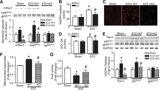FIG. 1. Effects of Rac1 knockout on NADPH oxidase and ROS production. Rac1-ko mice (KO) and their WT littermates were injected with STZ. Two months later, NADPH oxidase activation and expression and ROS production in heart tissues were measured. A: Translocalization of Rac1 and p67phox to the membrane. The protein levels of Rac1 (mRac1) and p67phox (mp67phox) were decreased in the membrane fractions of Rac1 KO compared with WT diabetic hearts. The top panel is the representative Western blot for membrane mRac1, mp67phox, and gp91phox from three out of five to six different hearts in each group, and the lower panel is the quantification of mRac1, mp67phox, and gp91phox. NADPH oxidase activity (B), superoxide production (C), and H2O2 production (D) were decreased in diabetic Rac1 KO compared with WT hearts. C is the representative DHE staining (Red signal) for superoxide production from five to six different hearts in each group. E: Rac1, p67phox, and gp91pho protein expression. The protein levels of Rac1 and p67pho were decreased in Rac1 KO compared with WT diabetic hearts. The top panel is the representative Western blot for Rac1, p67phox, and gp91phox from three out of five to six different hearts in each group and the lower panel is the quantification of Rac1, p67phox, and gp91phox. F: Mitochondrial superoxide production was increased in WT diabetic hearts, which was significantly decreased in Rac1 KO hearts. G: Thioredoxin reductase activity was preserved in Rac1 knockout diabetic hearts. Magnification ×40. Data are means ± SD, n = 5–8. *P < 0.05 vs. sham; #P < 0.05 vs. STZ in WT. (A high-quality digital representation of this figure is available in the online issue.)